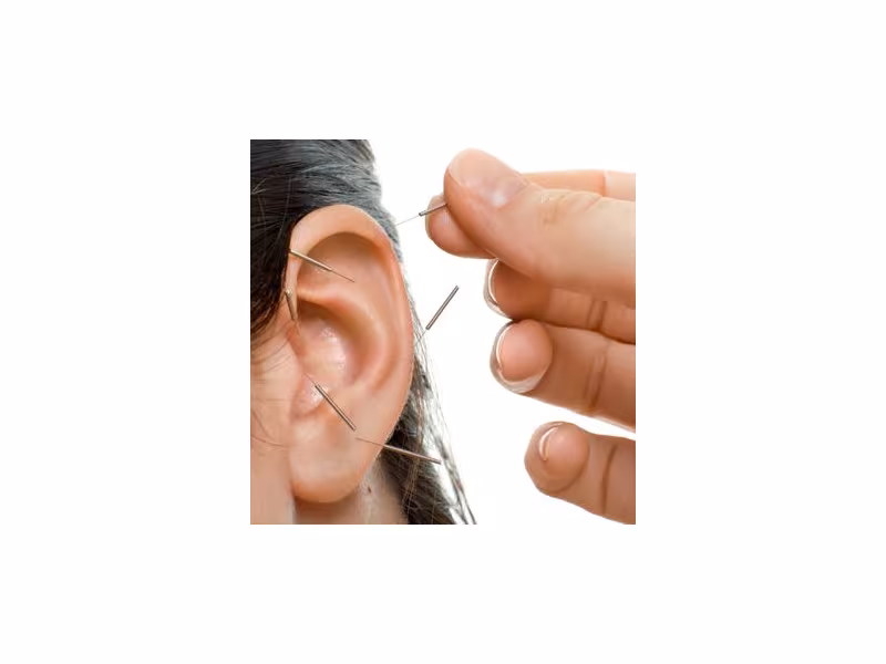 Cheng Acupuncture Wellness